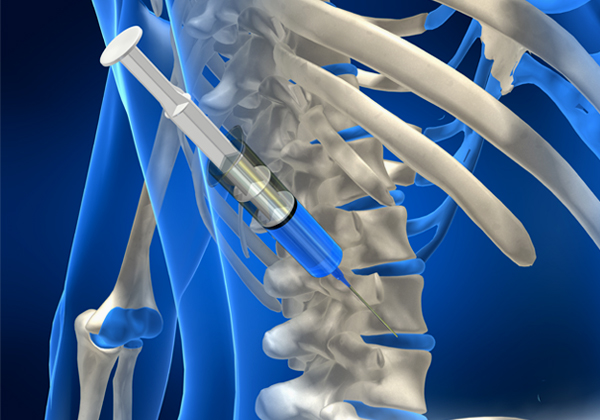 TPI, IMS Prolotherapy